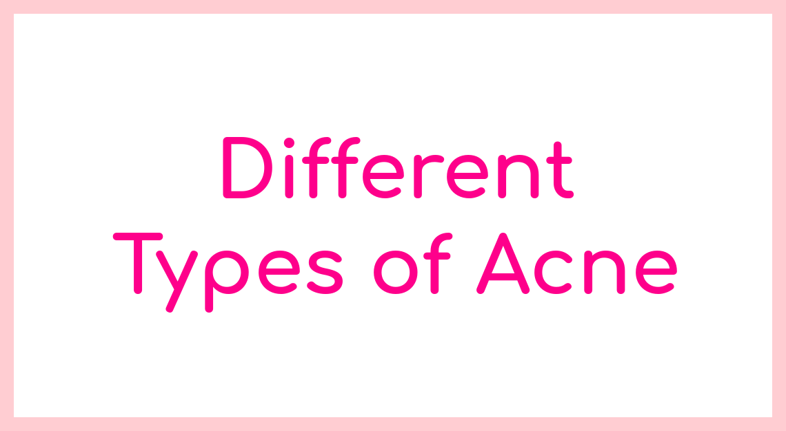 Different Types of Acne